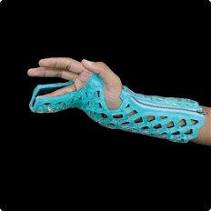 ExpProductCell_Ulnar Gutter Immobilizer