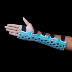 ExpProductCell_Splint or Slabs
